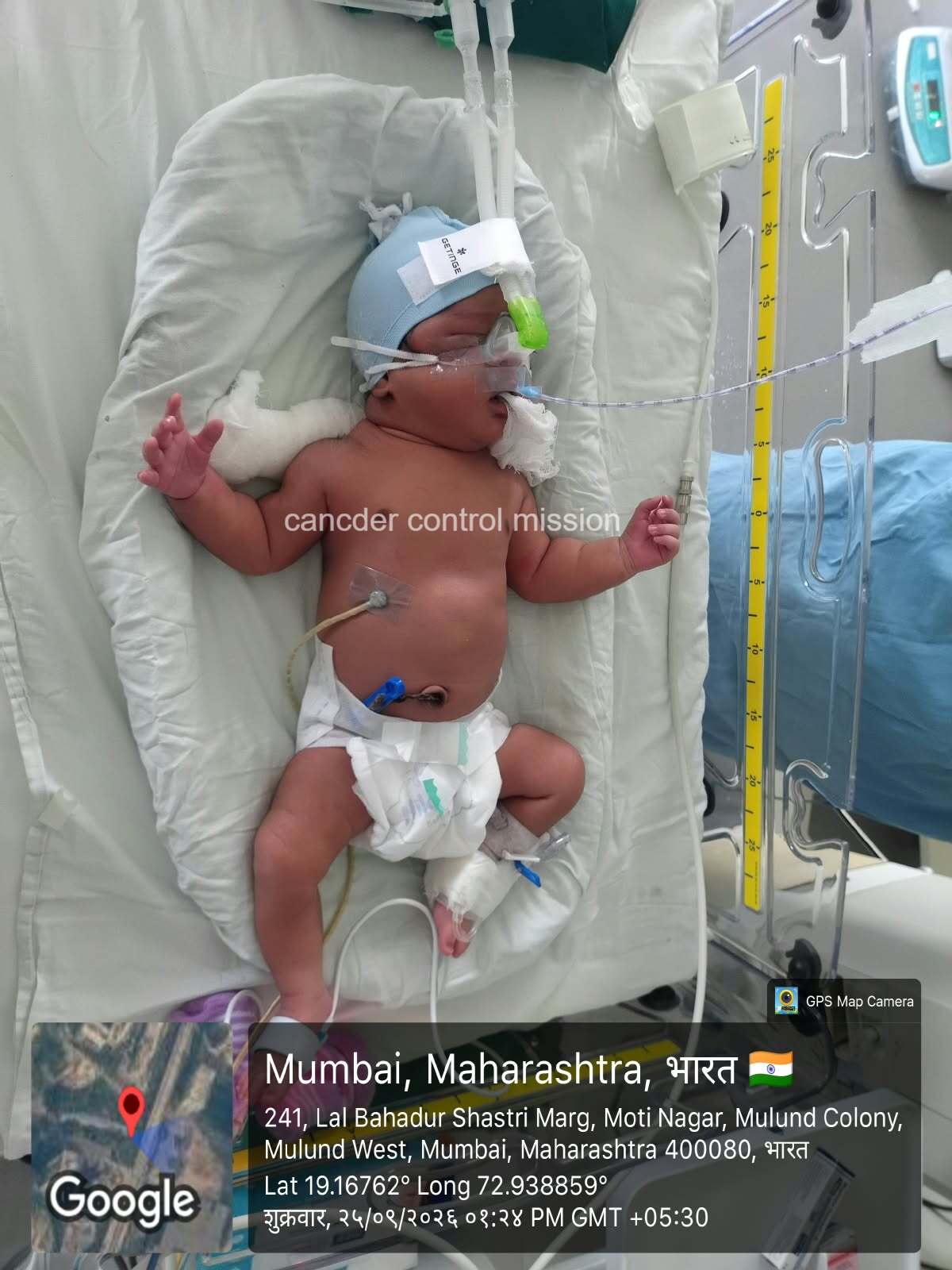 Help Baby of Sneha Yadav